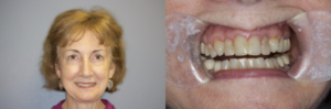 anti aging dentistry raleigh