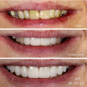 transform your smile at Russo Dentistry
