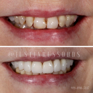 dentistry transformation pictures