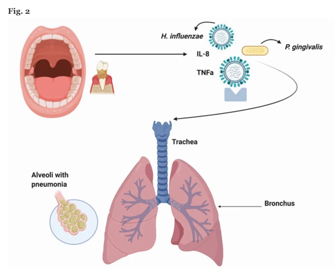 Visual journey of the passage of COVID-19