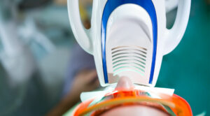zoom Teeth whitening